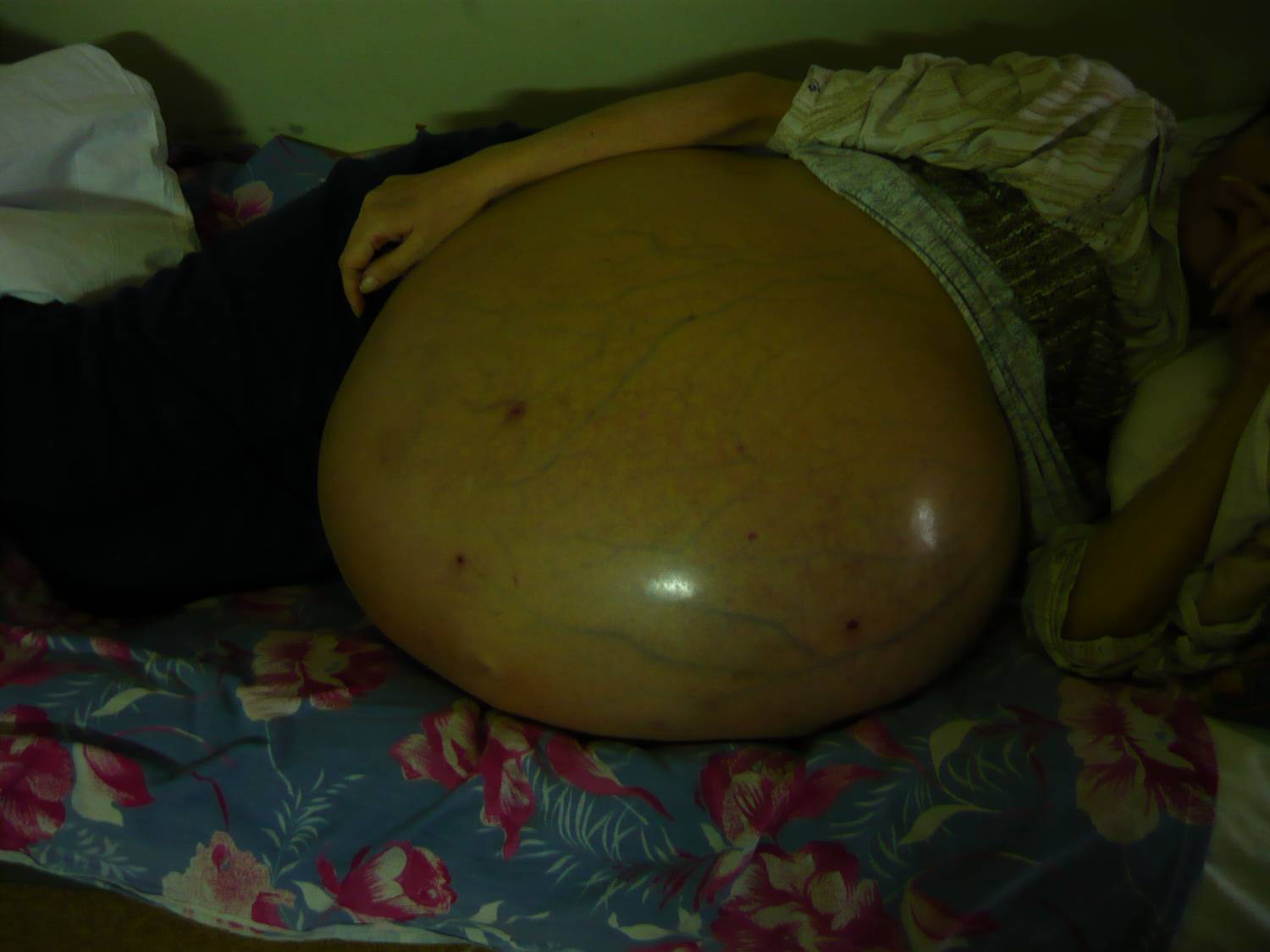 37 недель беременности из груди жидкость что это фото 55